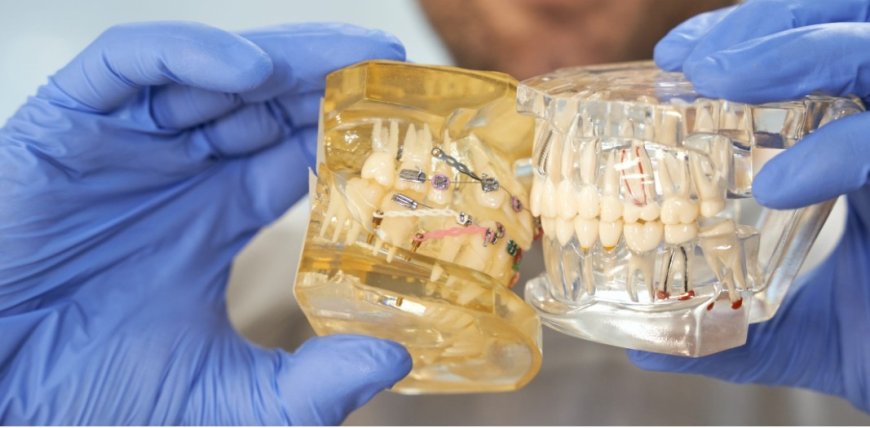 Diş Teli Lastiği: Doğru Kapanış ve Hızlanan Ortodontik Tedavinin Gizli Kahramanı