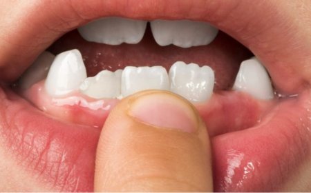 Diş sorunları genetik mi? Uzmanlar uyarıyor