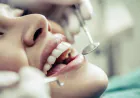 Görünmez diş teli nedir? Lingual ortodonti ile estetik tedavi