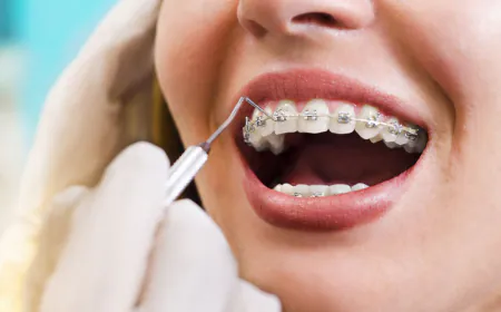 Ortodonti nedir? Diş ve çene bozukluklarında tedavi yöntemleri