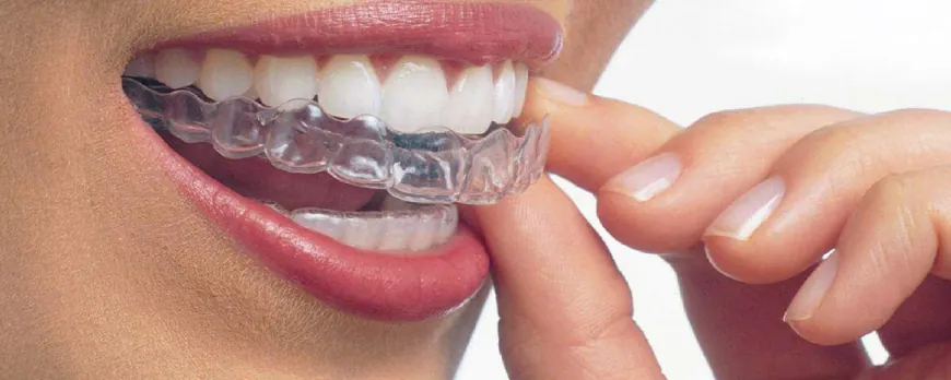 Hareketli ortodontik tedavi nedir? Avantajları ve uygulama yaşı